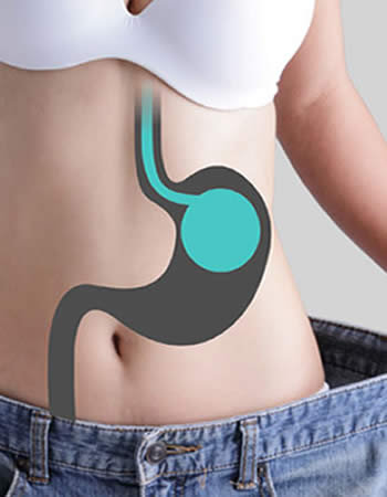 <balon gastrico ambato>